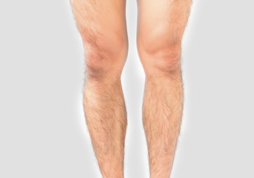 Full Legs