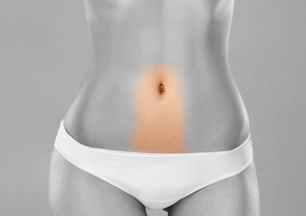 Belly line 