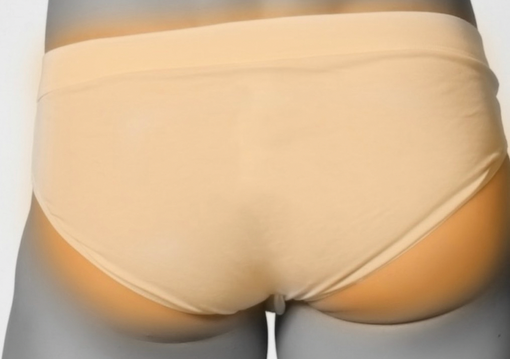 Buttocks