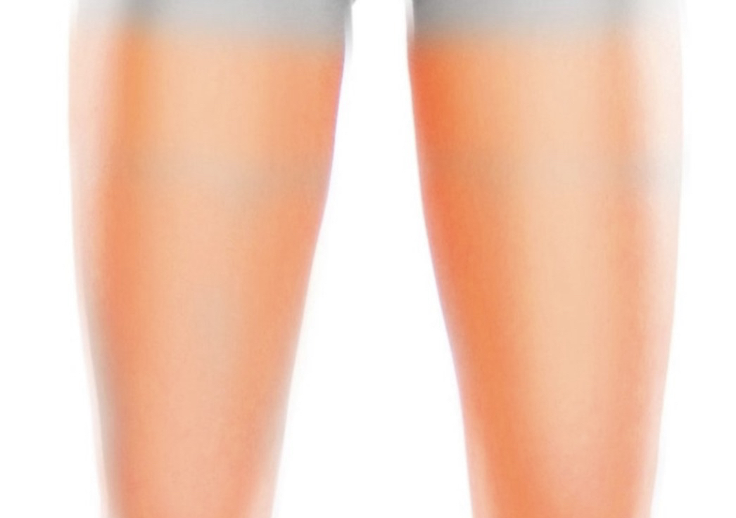 Upper Leg (Thigh)