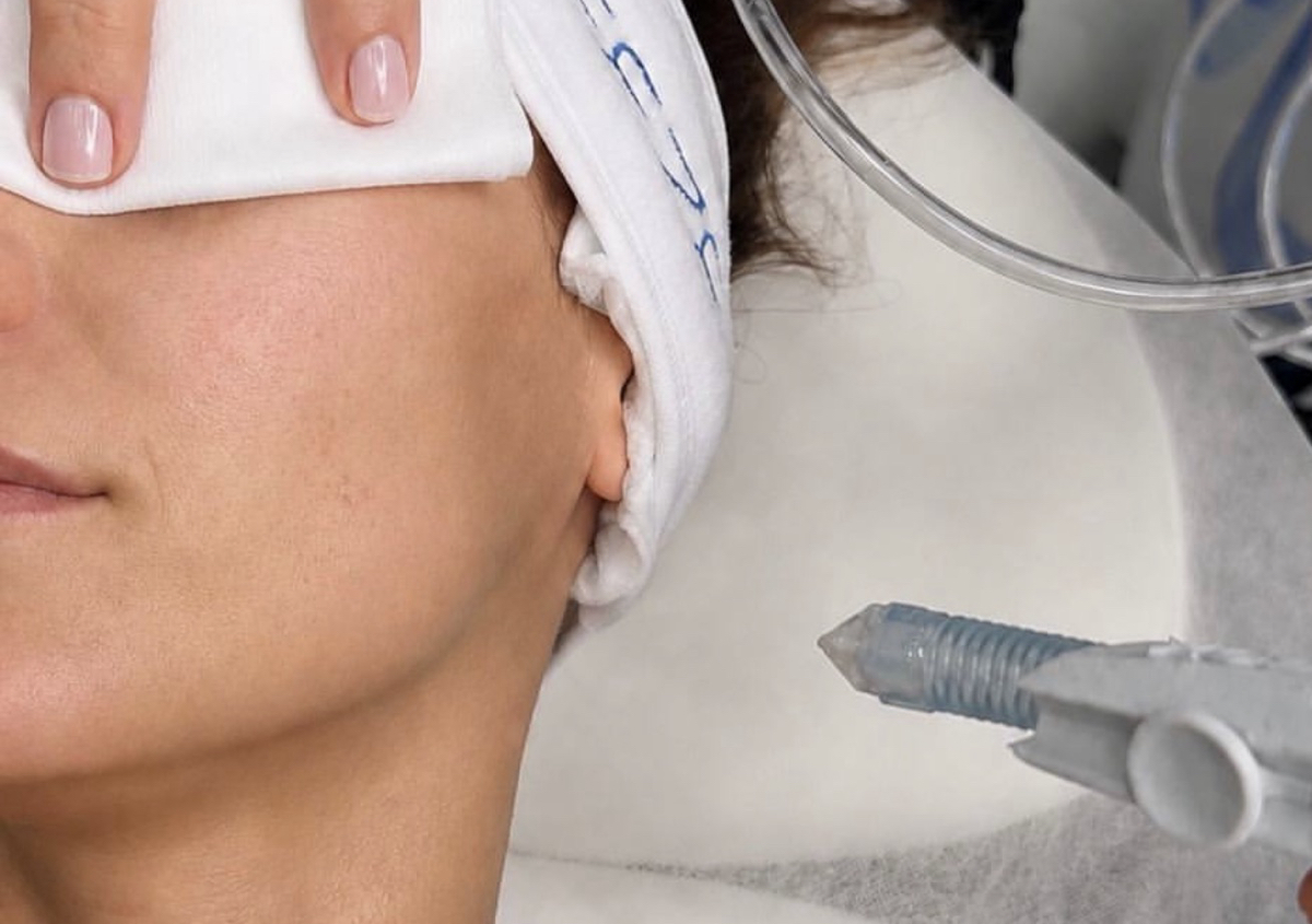 BREEZE Red Carpet Facial