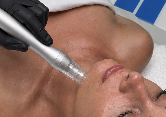 The HydroDiamond Facial