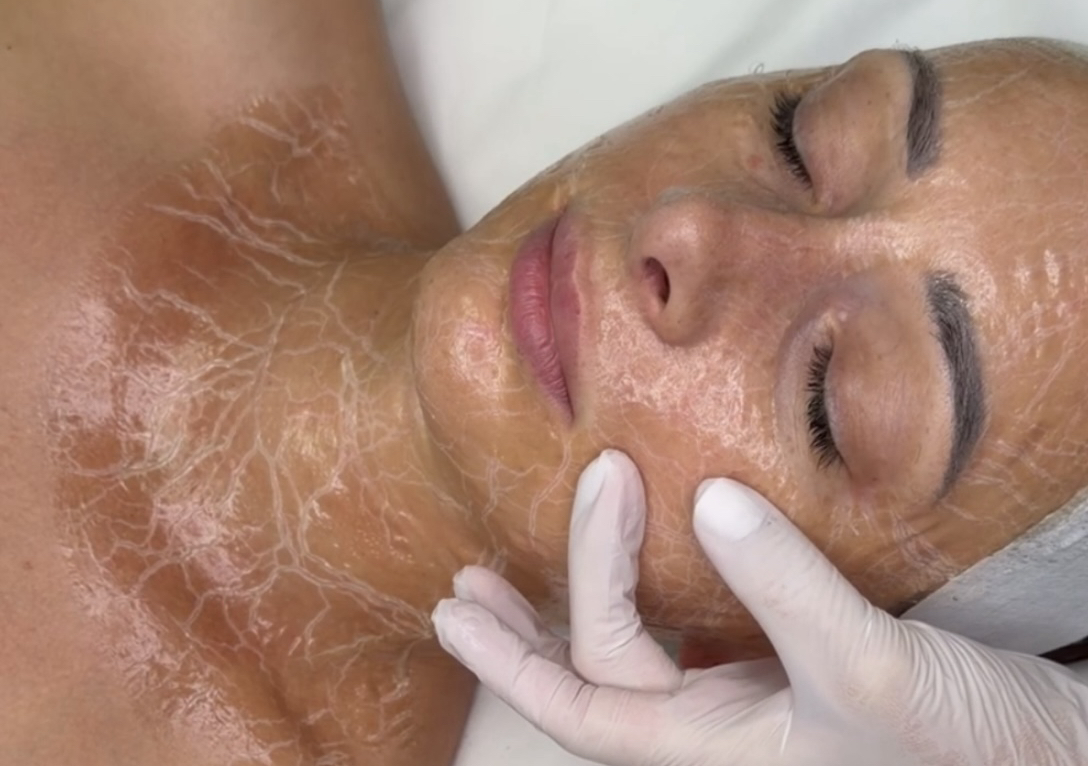 Lume Timeless Facial