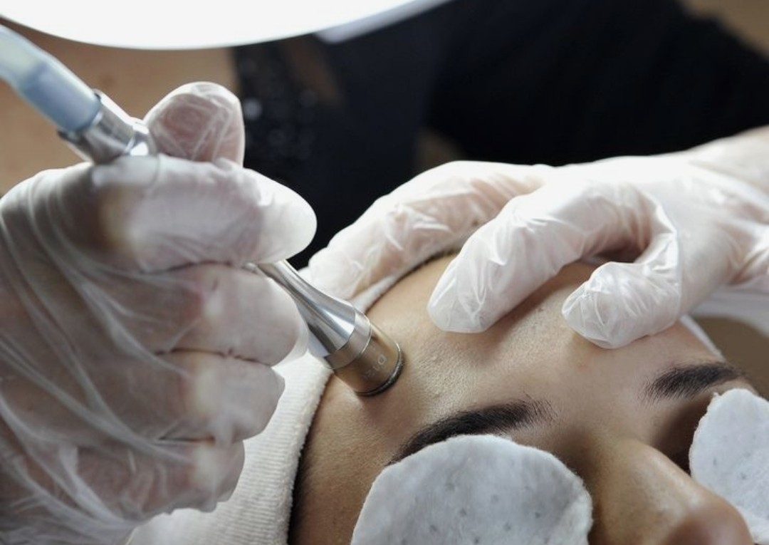 Clean and glow facial (Microdermabrasion + Oxygen infusion +hf)