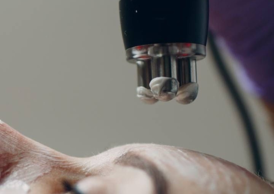 Rejuvenation facial (Radio frequency (RF) +Led light therapy +hf)