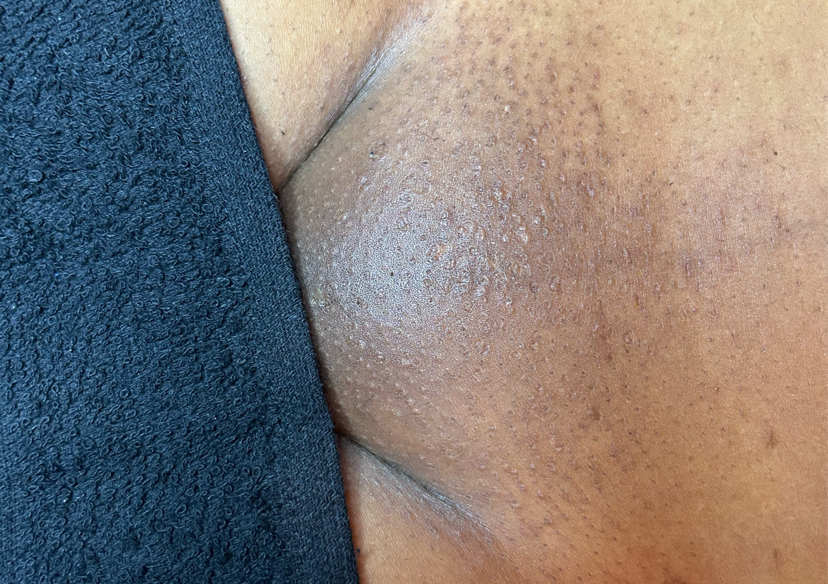 Bra-Jacial ( Fall Savings)