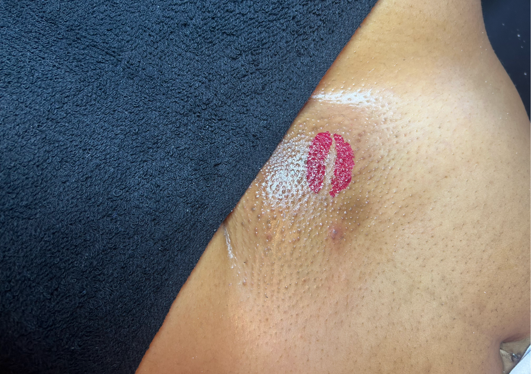 Brazilian  ( SUGARING)