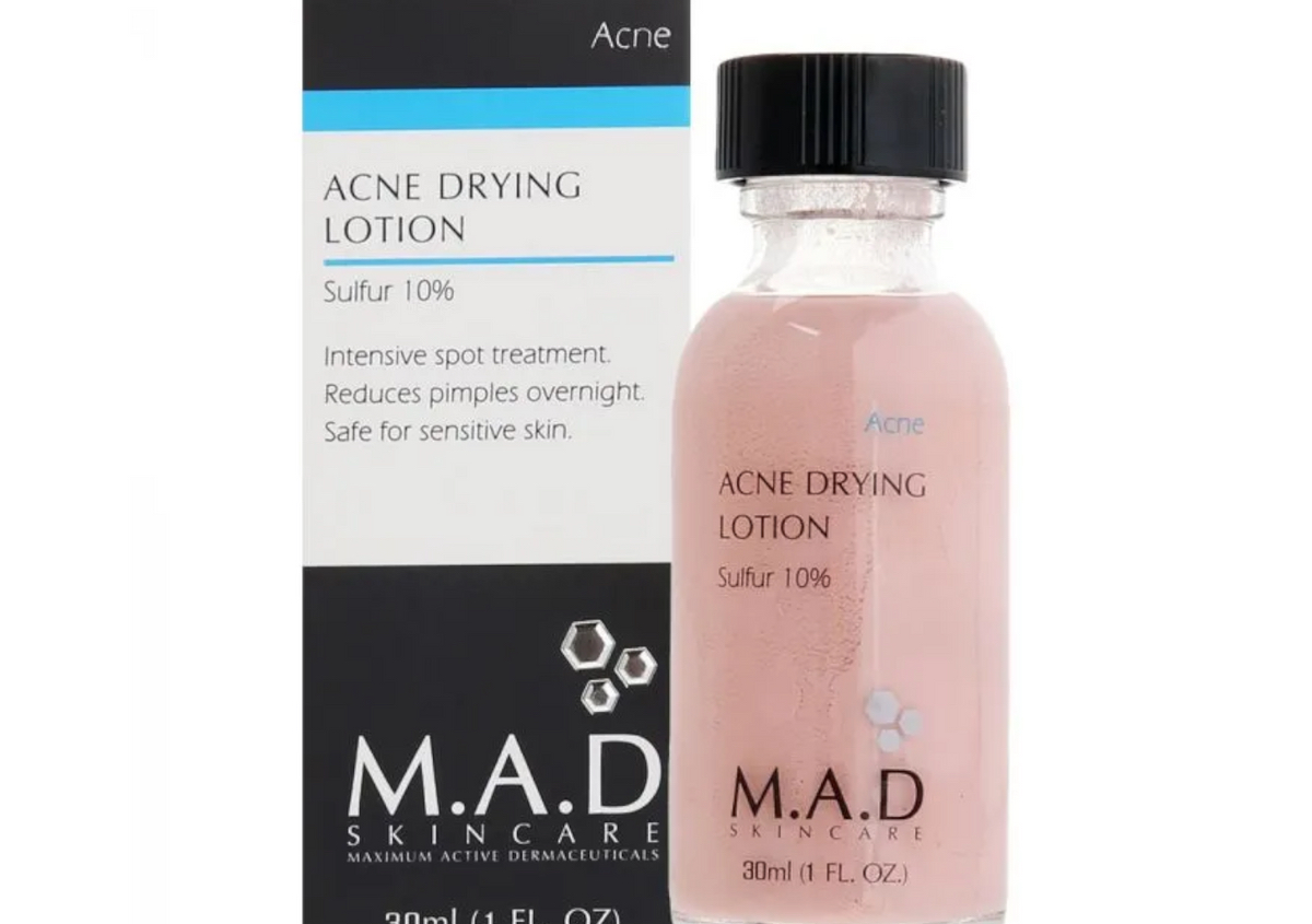 Acne drying lotion
