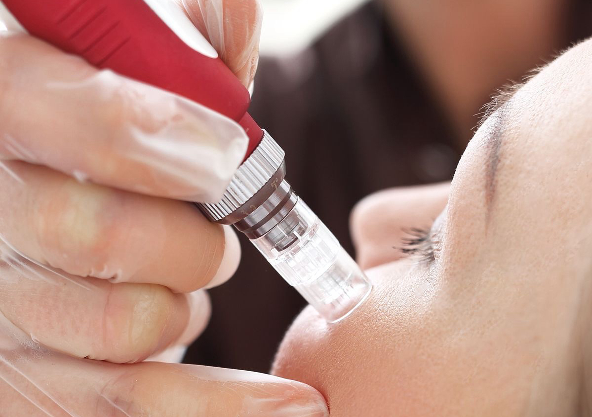 Microneedling + Facial