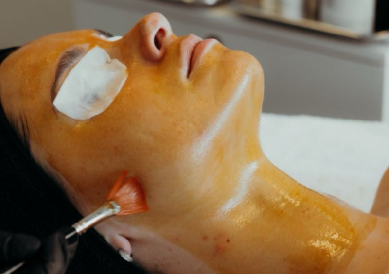 Chemical Peeling + Facial