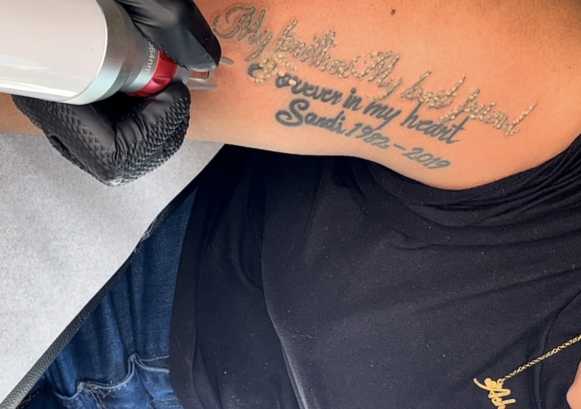 𝐋𝐚𝐫𝐠𝐞 𝐓𝐚𝐭𝐭𝐨𝐨 𝐑𝐞𝐦𝐨𝐯𝐚𝐥