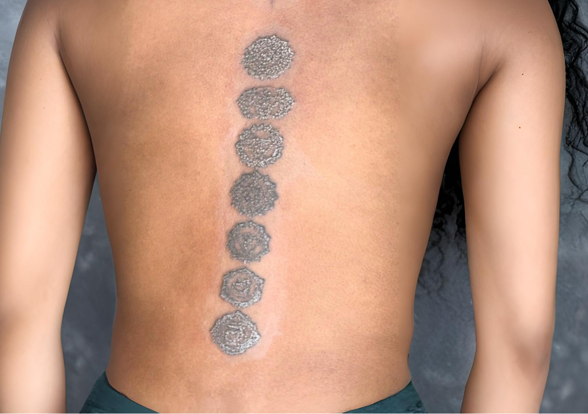 𝐗𝐋 𝐓𝐚𝐭𝐭𝐨𝐨 𝐑𝐞𝐦𝐨𝐯𝐚𝐥