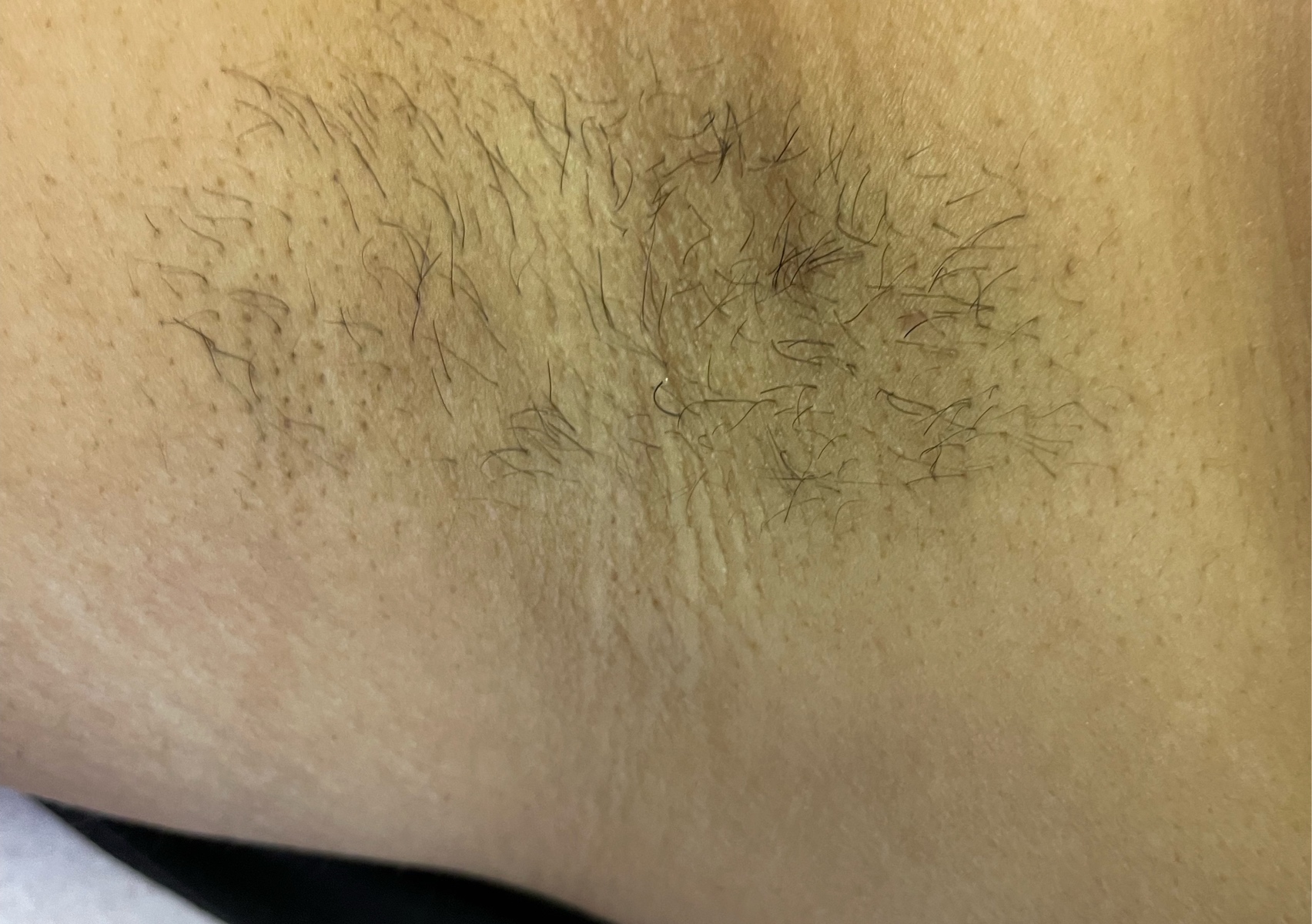 Wax under arms