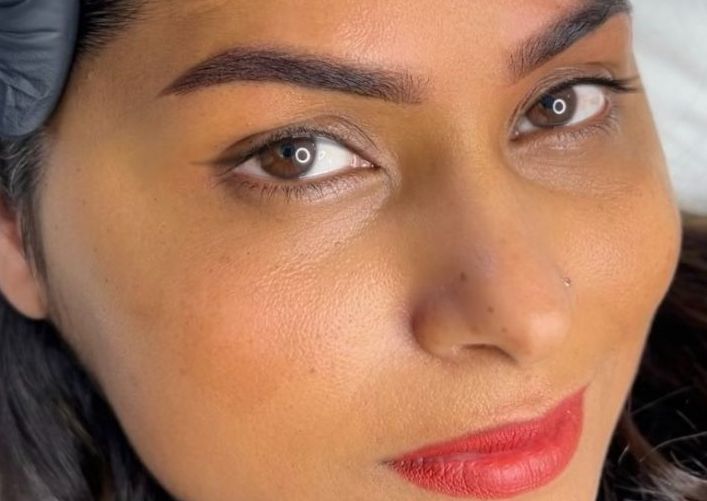 AFTER 4-12 WEEKS TOUCH-UP (Existing Clients Only)