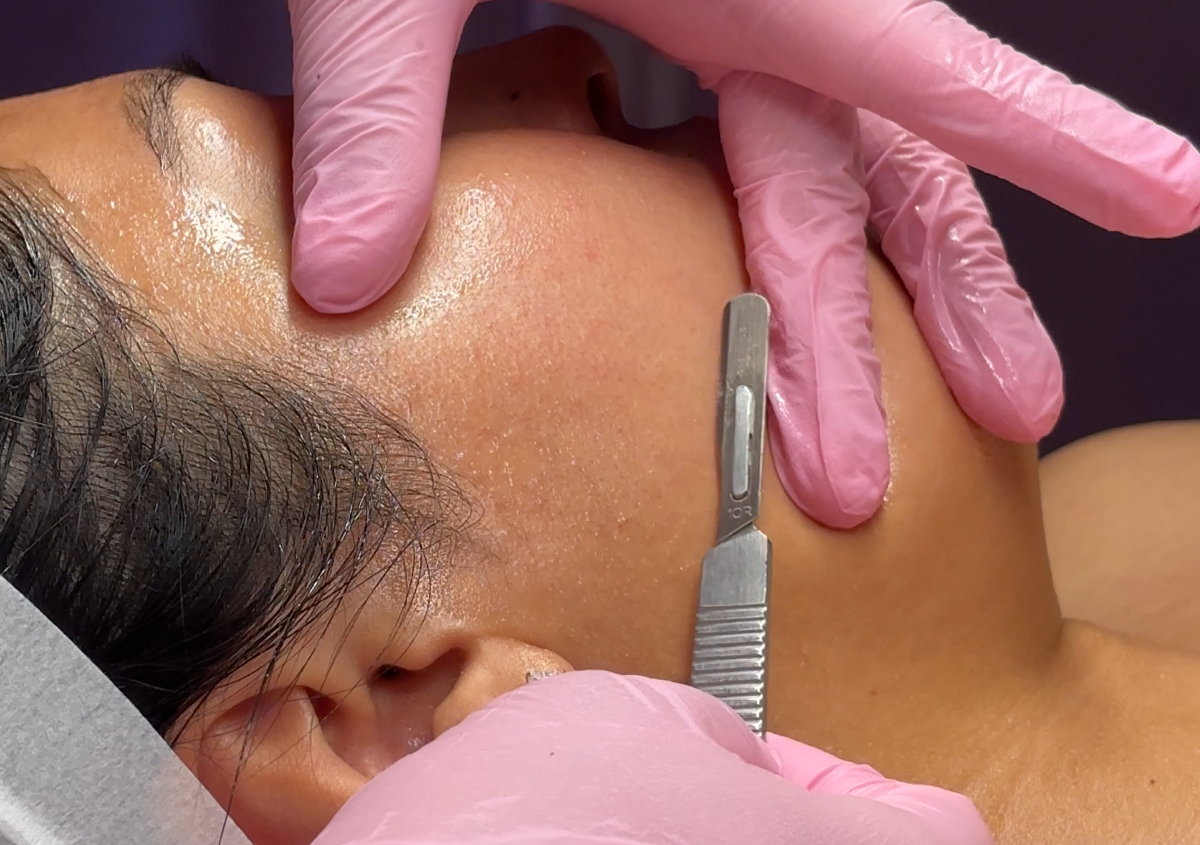 Dermaplane Facial