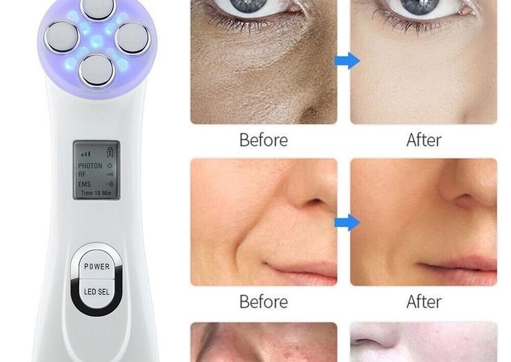 5 in 1 ems ref and light therapy treatment for acne scarring and pigmentation and fine lines. (2/4)
