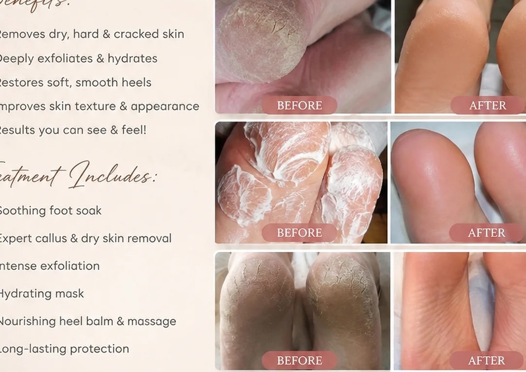 Medical foot treatment with a foot treatment  (2/3)