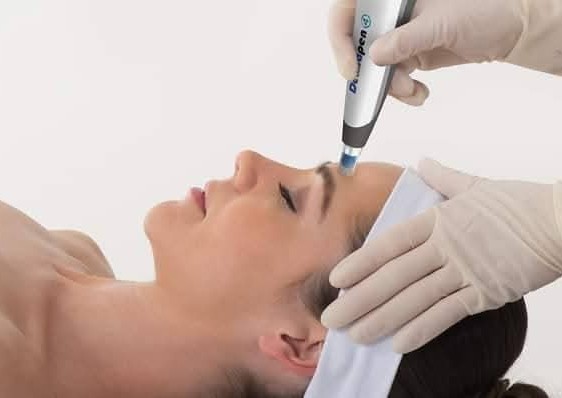 Diamond peel dermabrasion facial Treatment  (5/5)