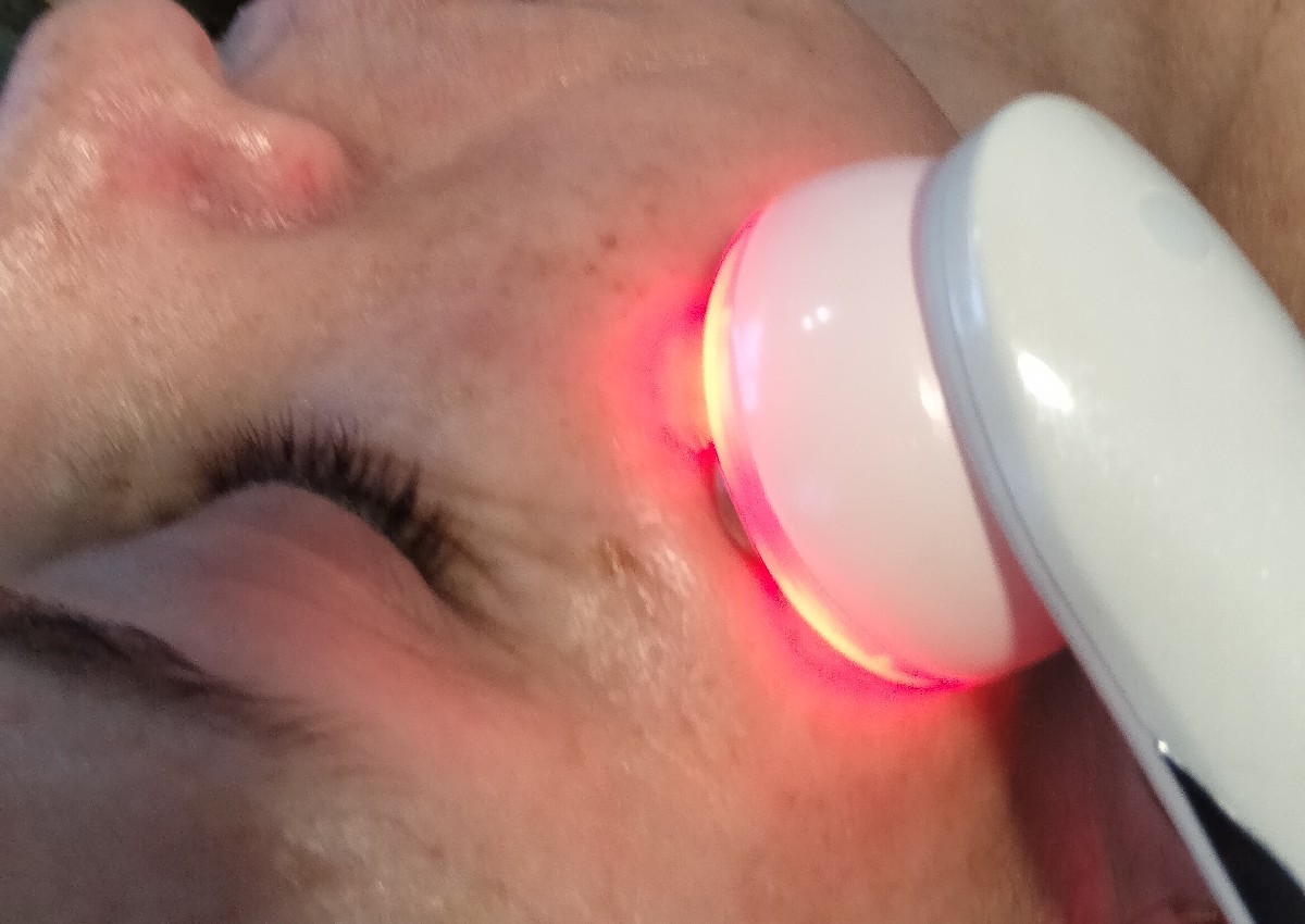 5 in 1 ems ref and light therapy treatment for acne scarring and pigmentation and fine lines. (3/4)