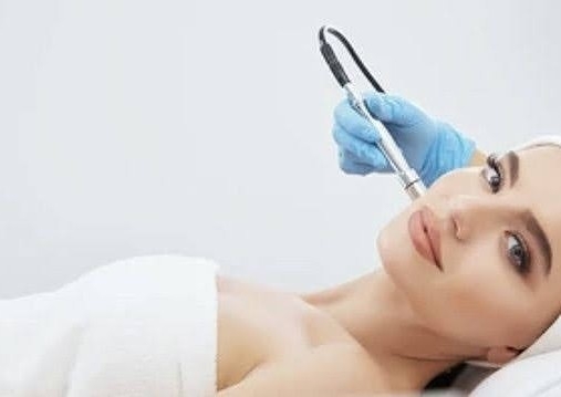 Diamond peel dermabrasion facial Treatment 