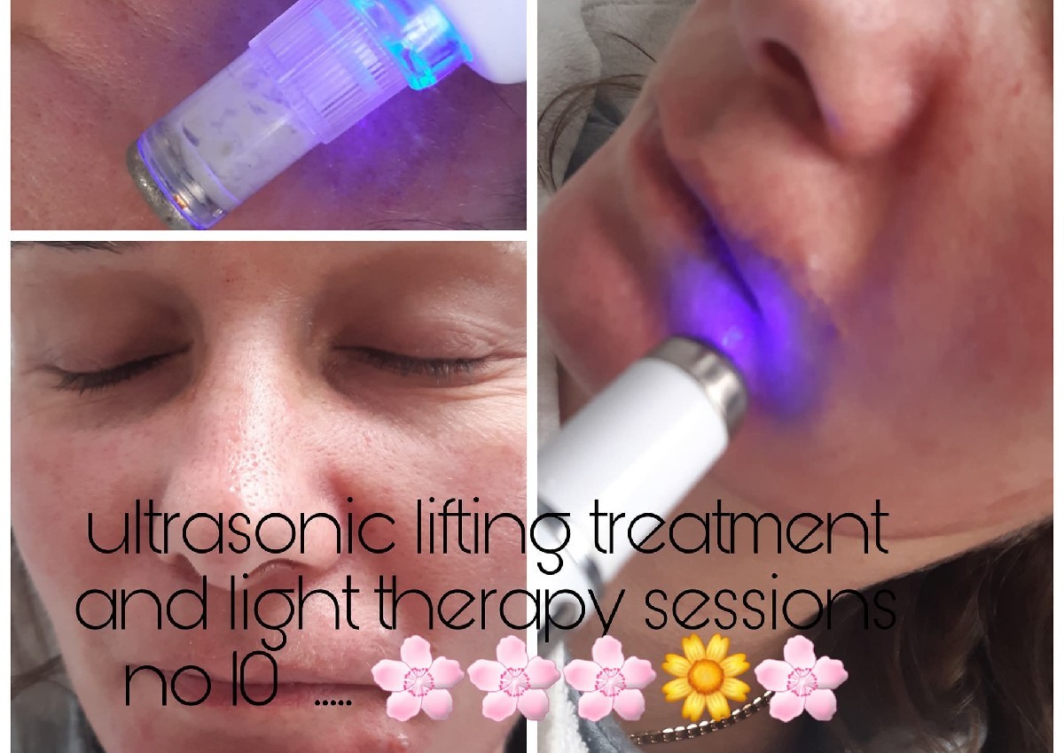 Diamond peel dermabrasion facial Treatment  (4/5)
