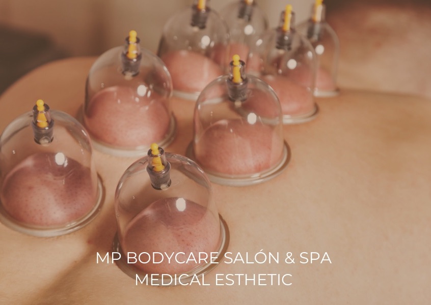 Vacuum Therapy / Vacuoterapia