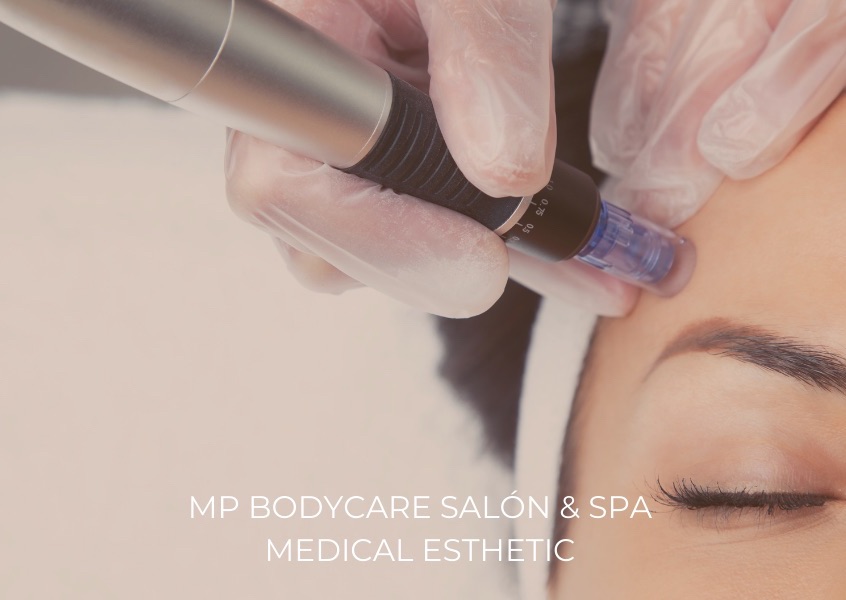 Microneedling / Microneedling