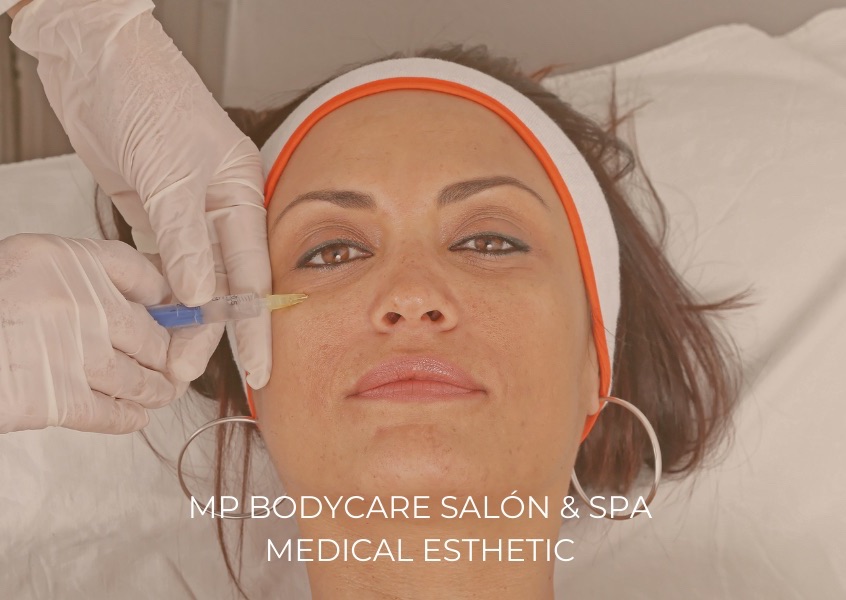 Under-Eye Filler / Relleno de Ojeras