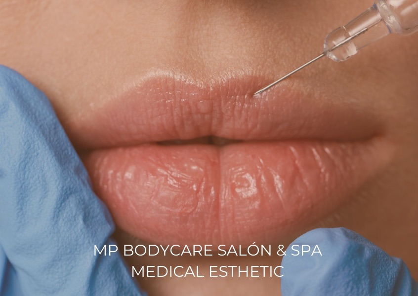 Micro Lips with Collagen / Micro Lips con Colágeno