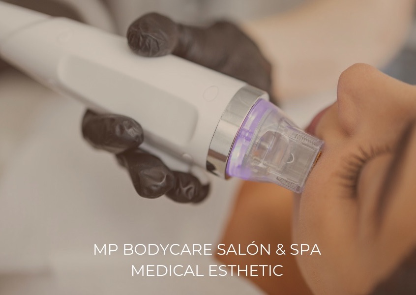 6 Sessions Nano RF + Microchanneling / 6 Sesiones Nano RF + Microchanneling