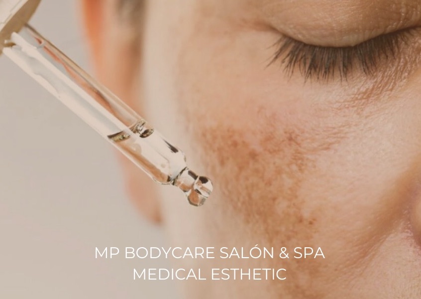 Melasma Treatment with WPRT & Stem Cell II / Tratamiento para Melasma con WPRT & Stem Cell II