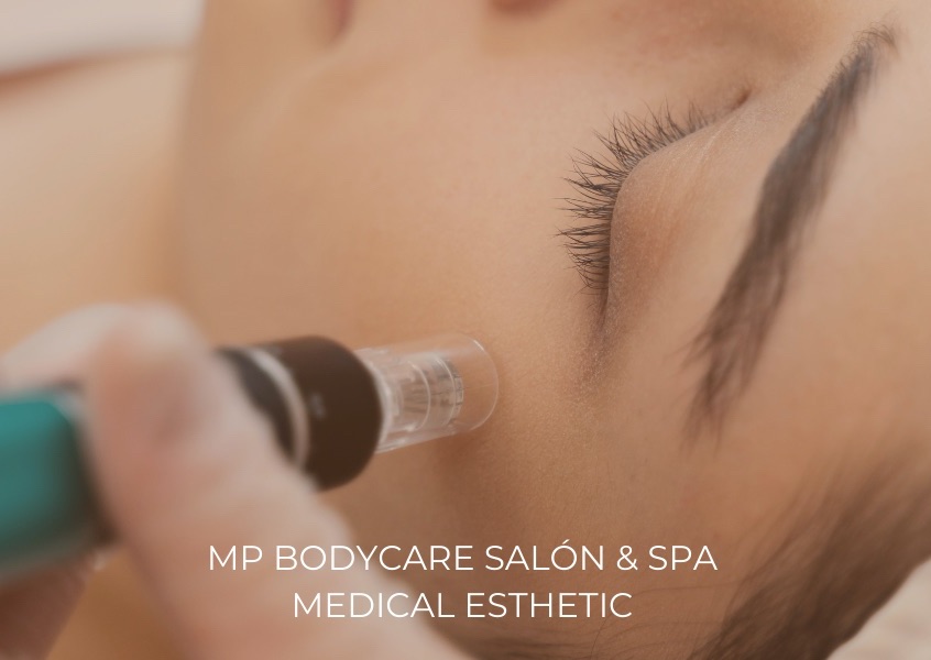 Exosome Therapy / Tratamiento de Exosomas