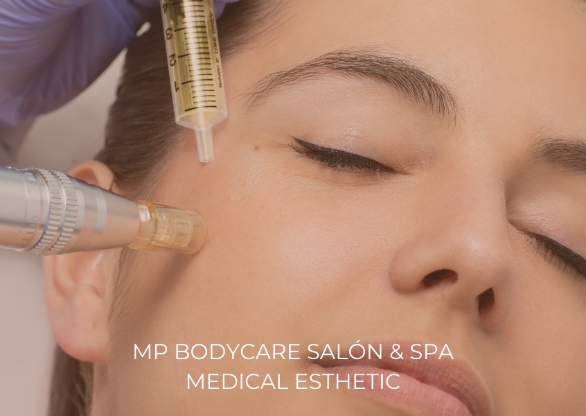 PRP with Facial / PRP con Facial