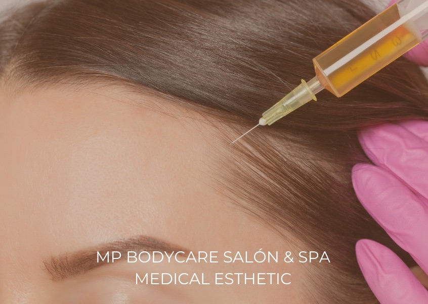 PRP Face, Chin, Scalp & Hands / PRP Rostro, Papada, Capilar y Manos