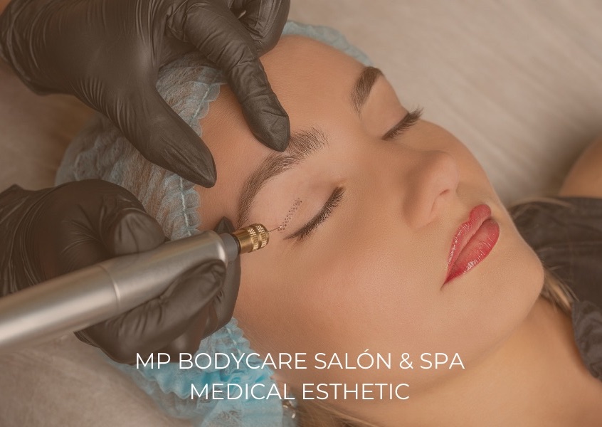 Fibroblast Full Face & Chin / Fibroblast Rostro Completo y Papada