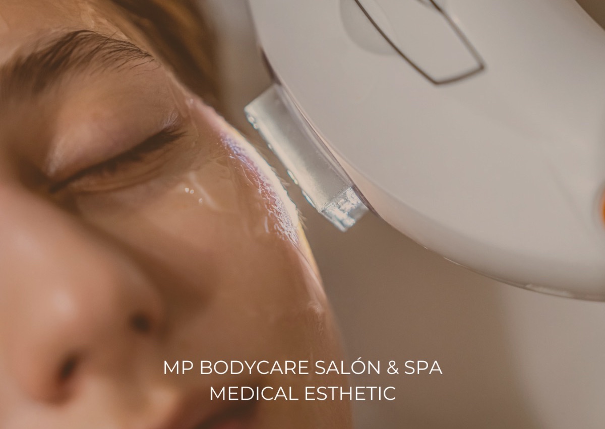 Photorejuvenation / Fotorejuvenecimiento