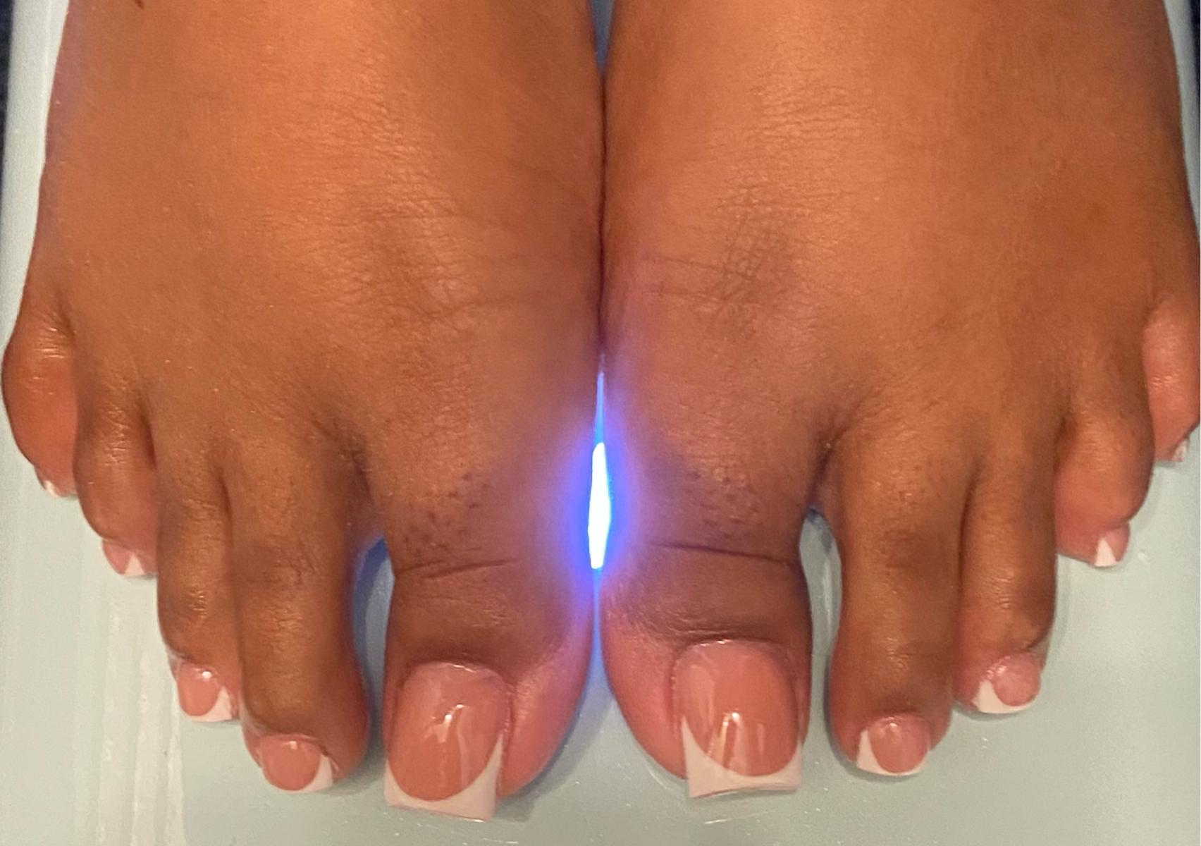 Acrylic on all Toes French Design