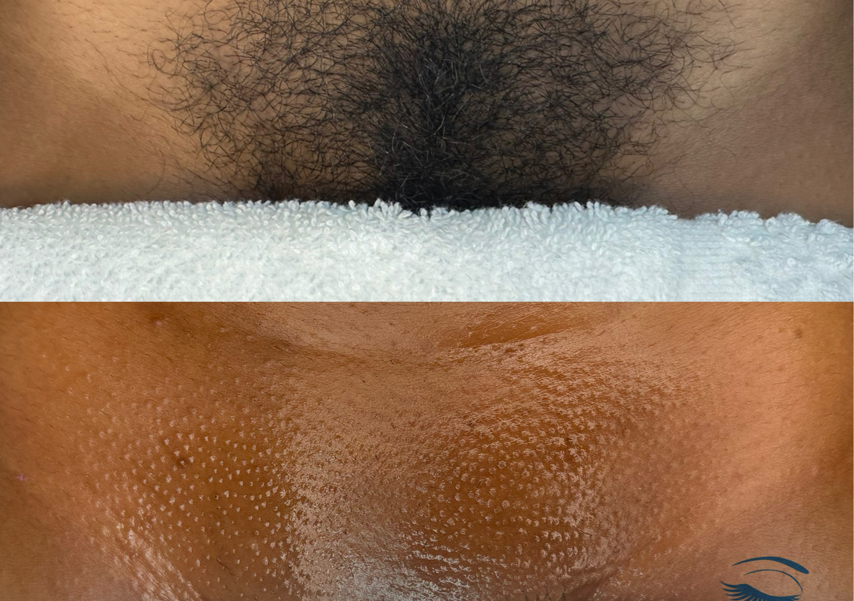 Women-Basic Brazilian