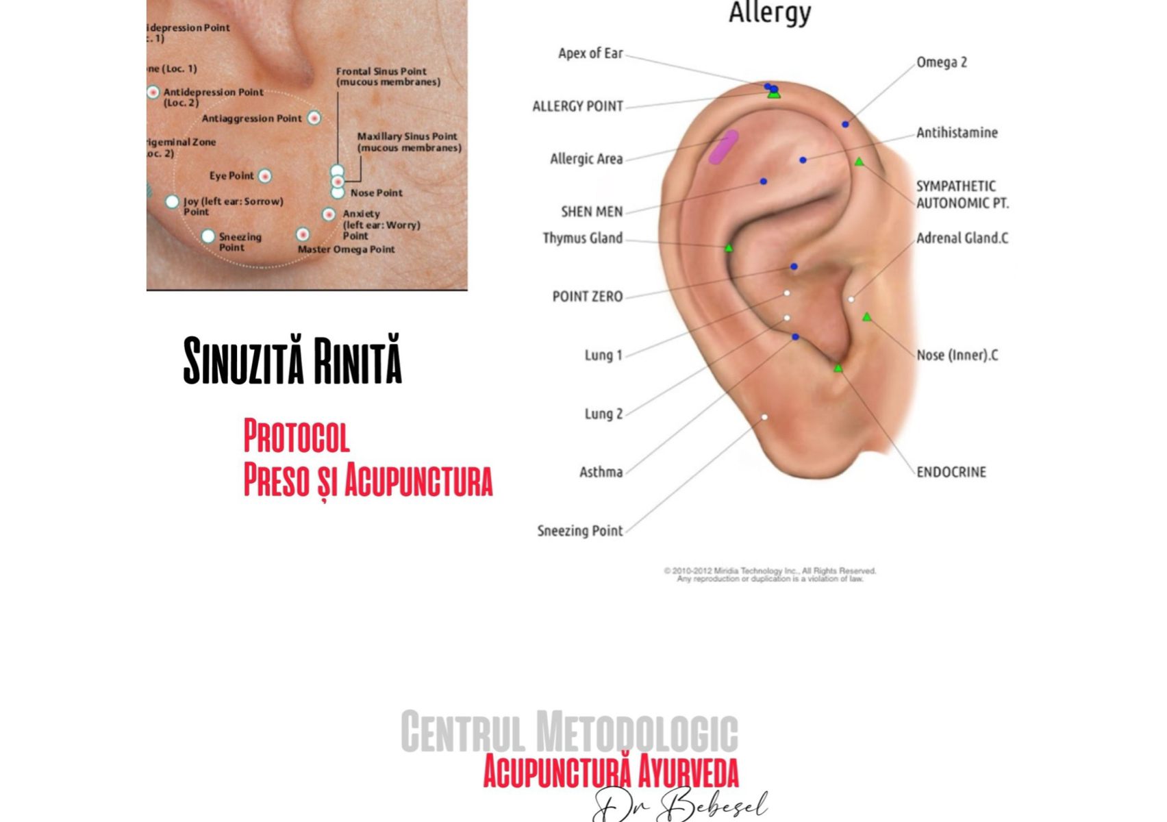 Sinuzita RinitaAlergica 6 sedinte