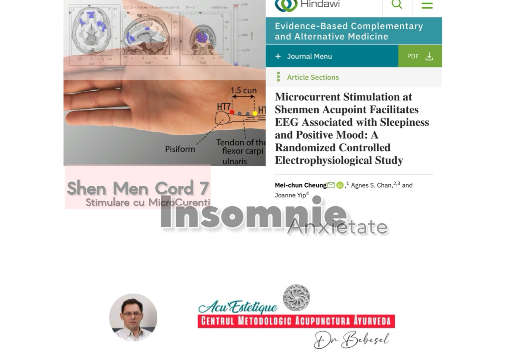 Oboseală Insomnie 10 sedinte