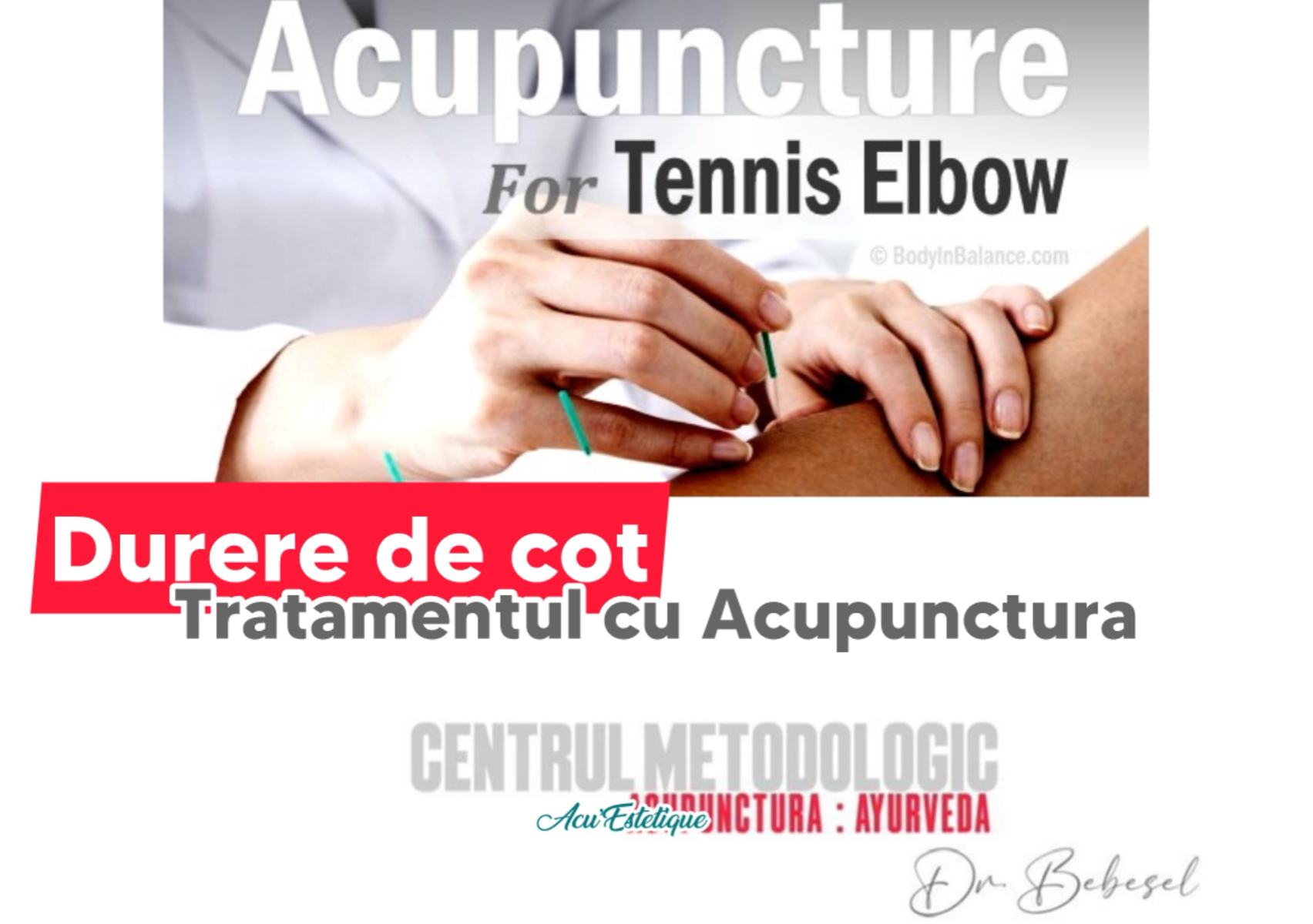 Cotul tenismenului 6 sedinte x 1h