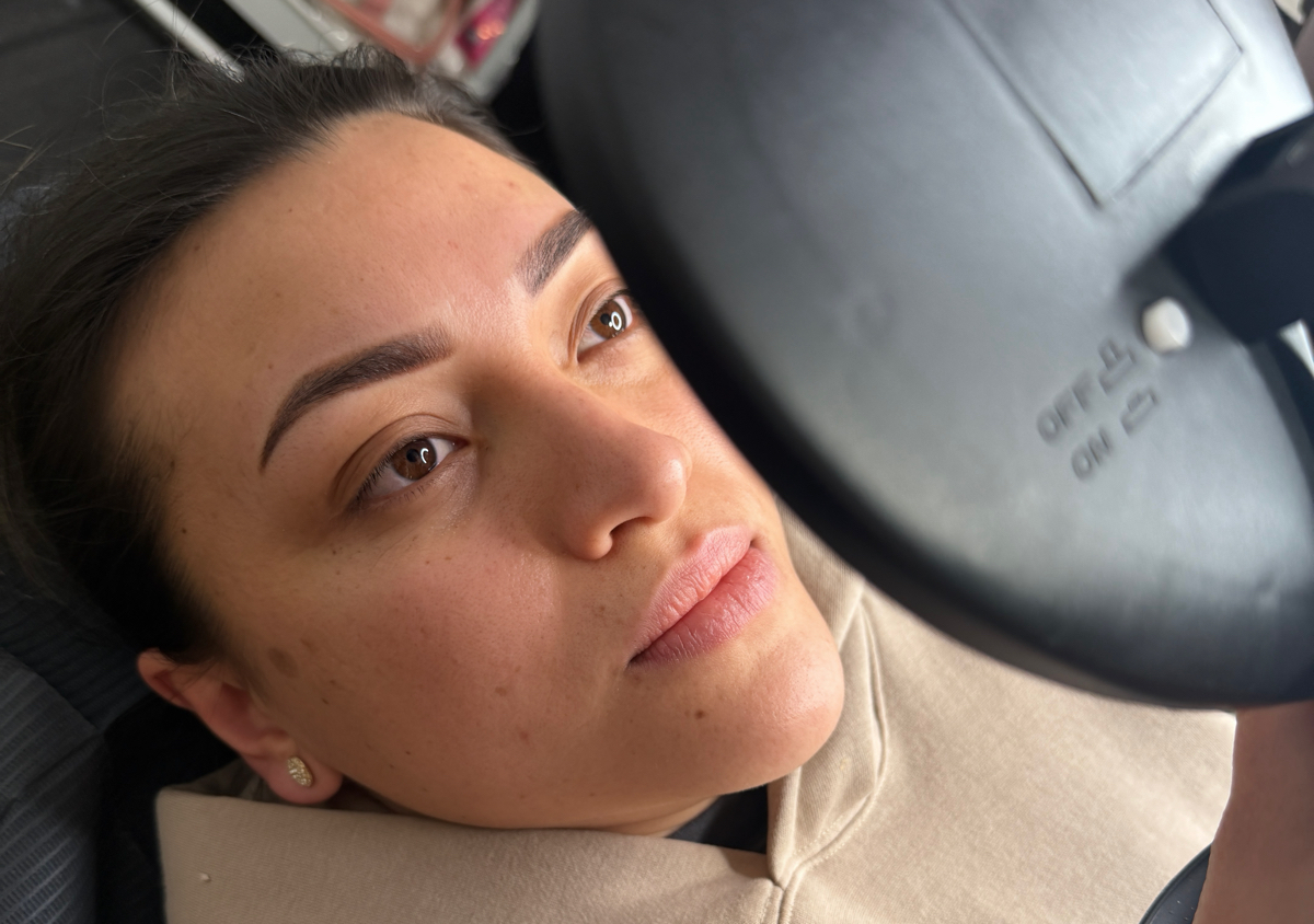 Micropigmentation toup up one month later