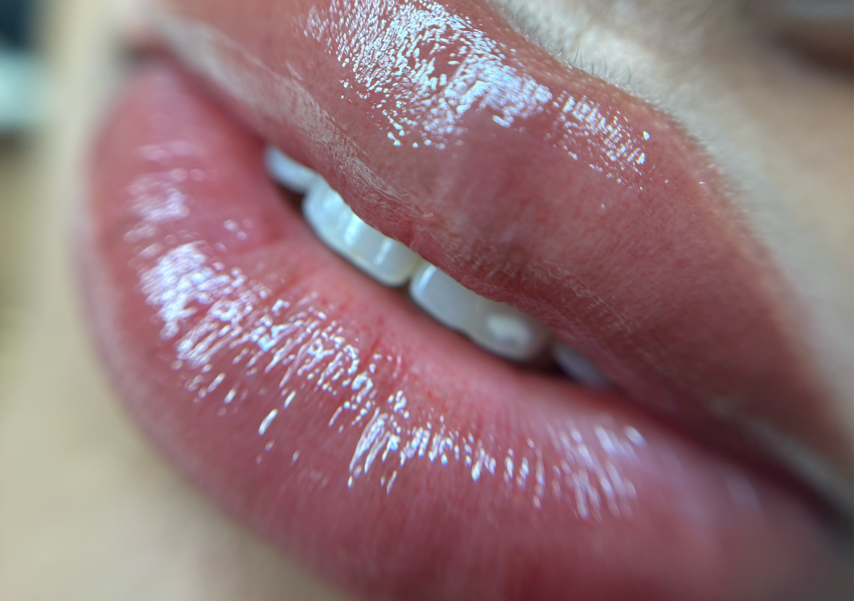 Neutraluzacion labial