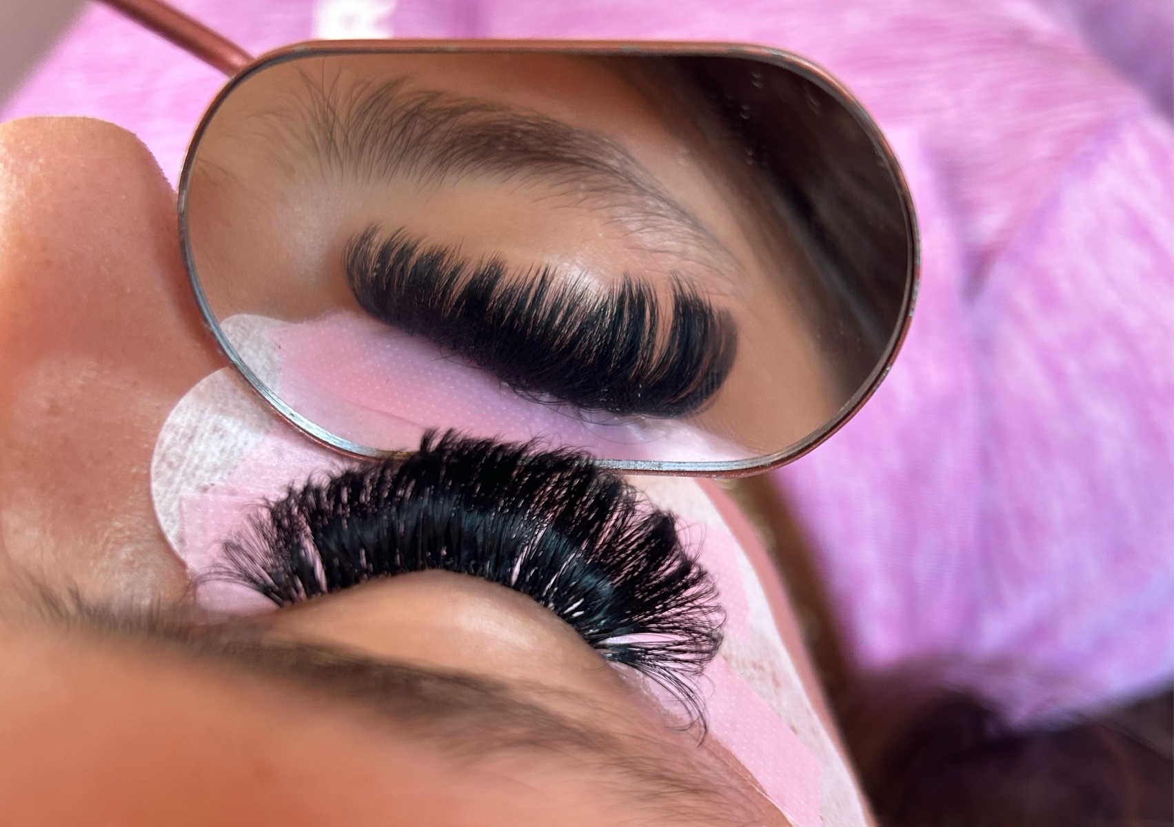 Mega volume infill (3-4 weeks)