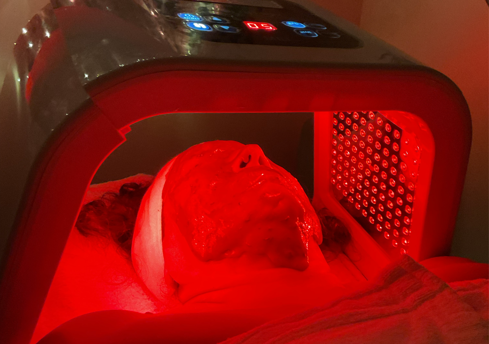 Limpieza facial profunda 