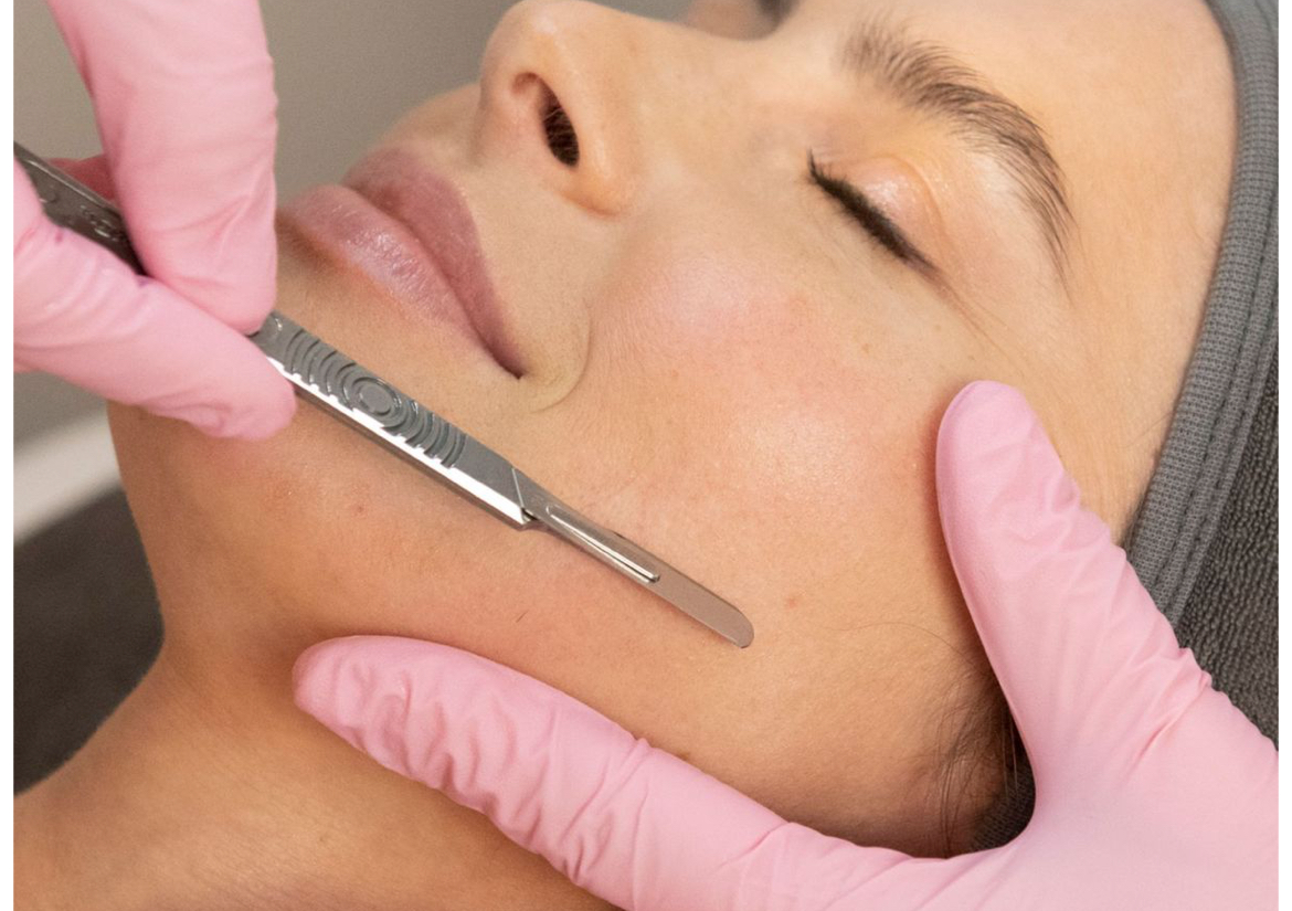 Dermaplaning 
