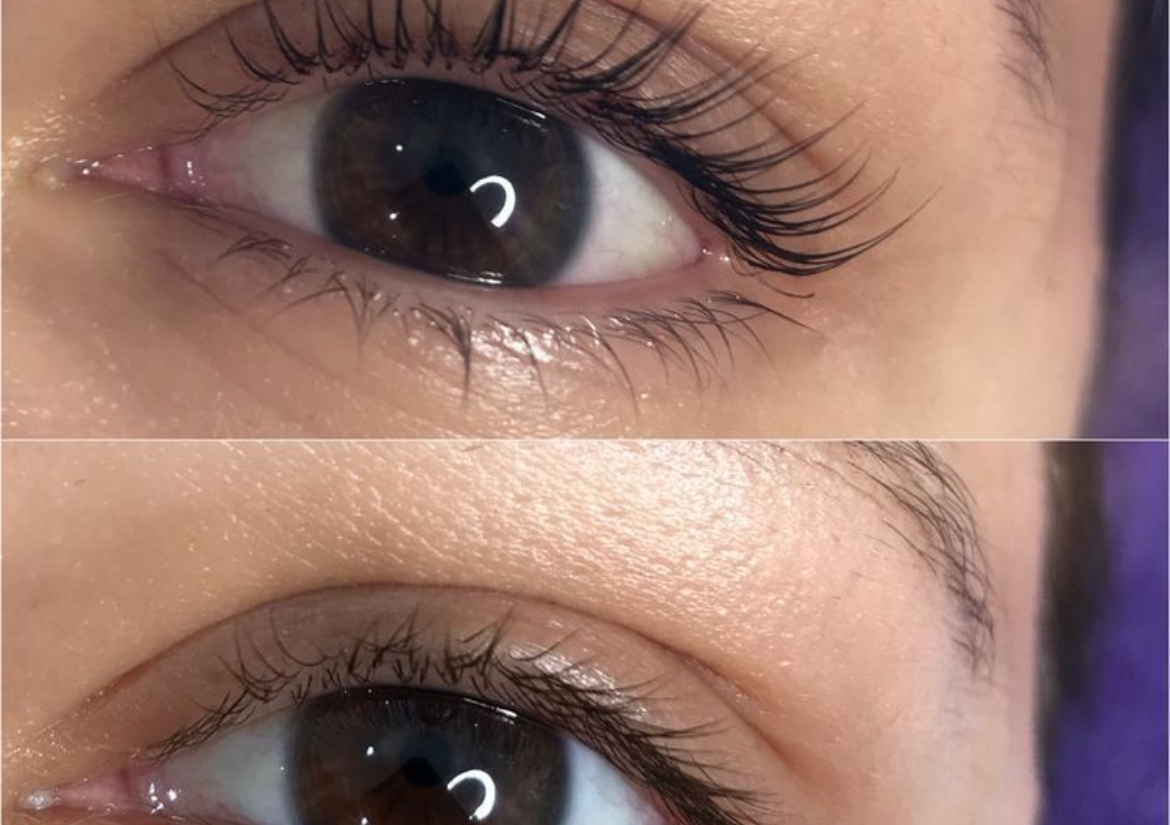 Lifting de pestañas 