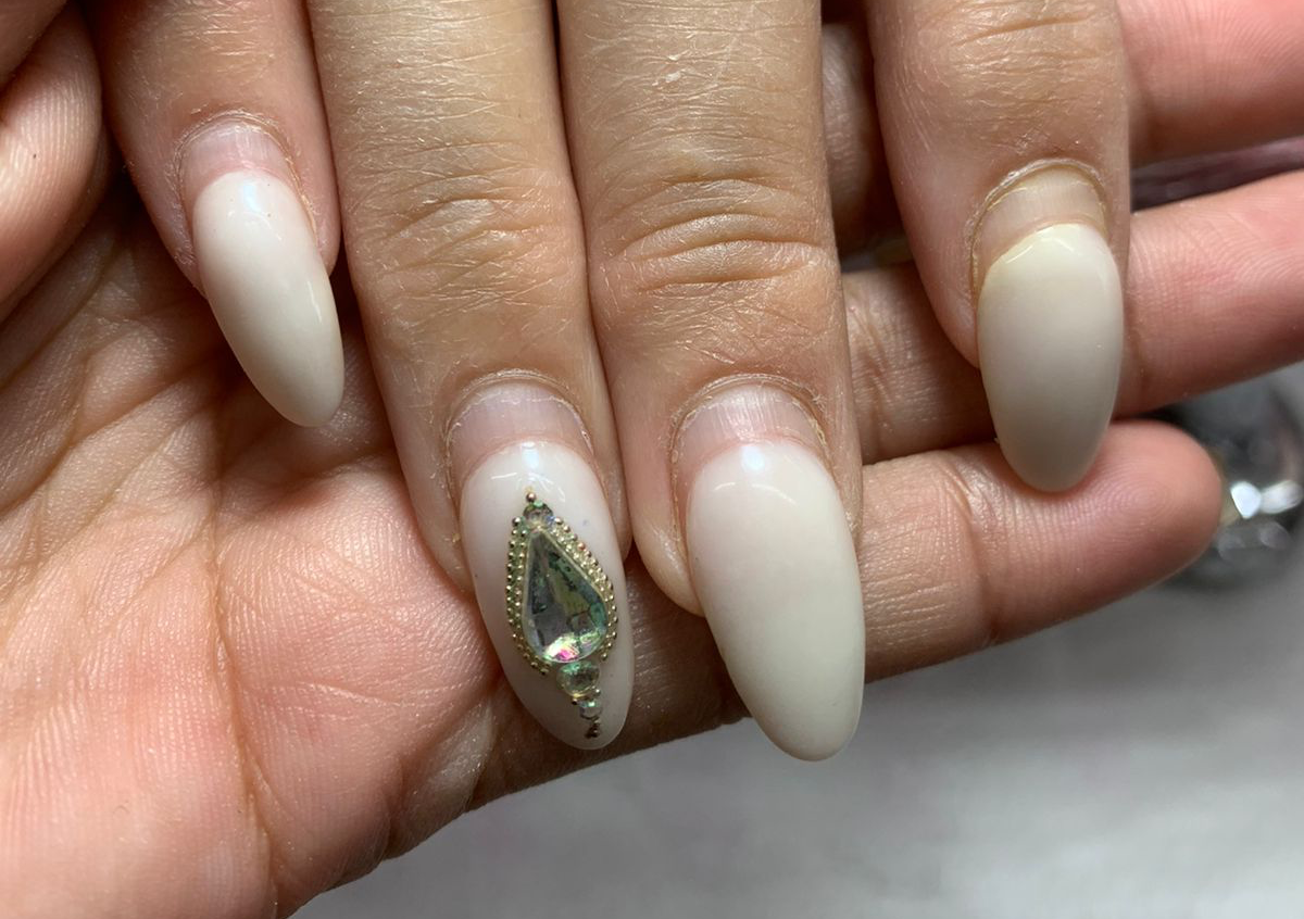  (kapping) o mantenimiento