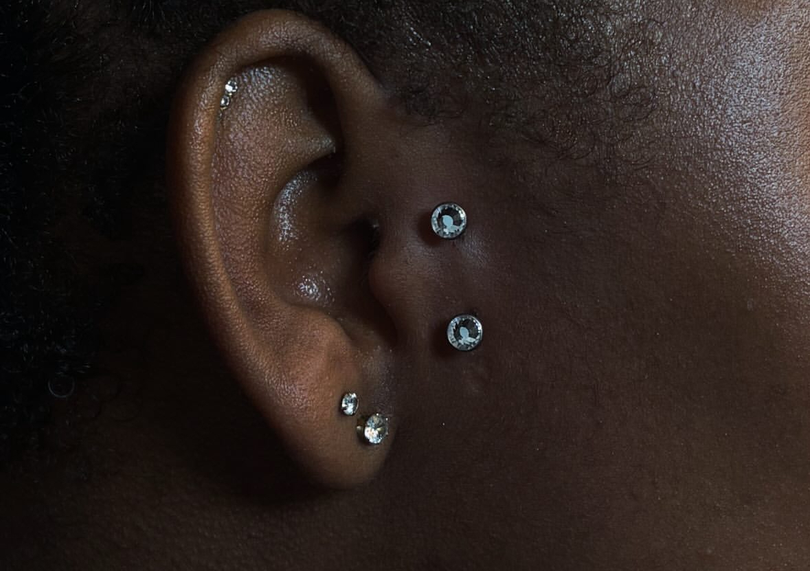 Surface (unti-back-side)