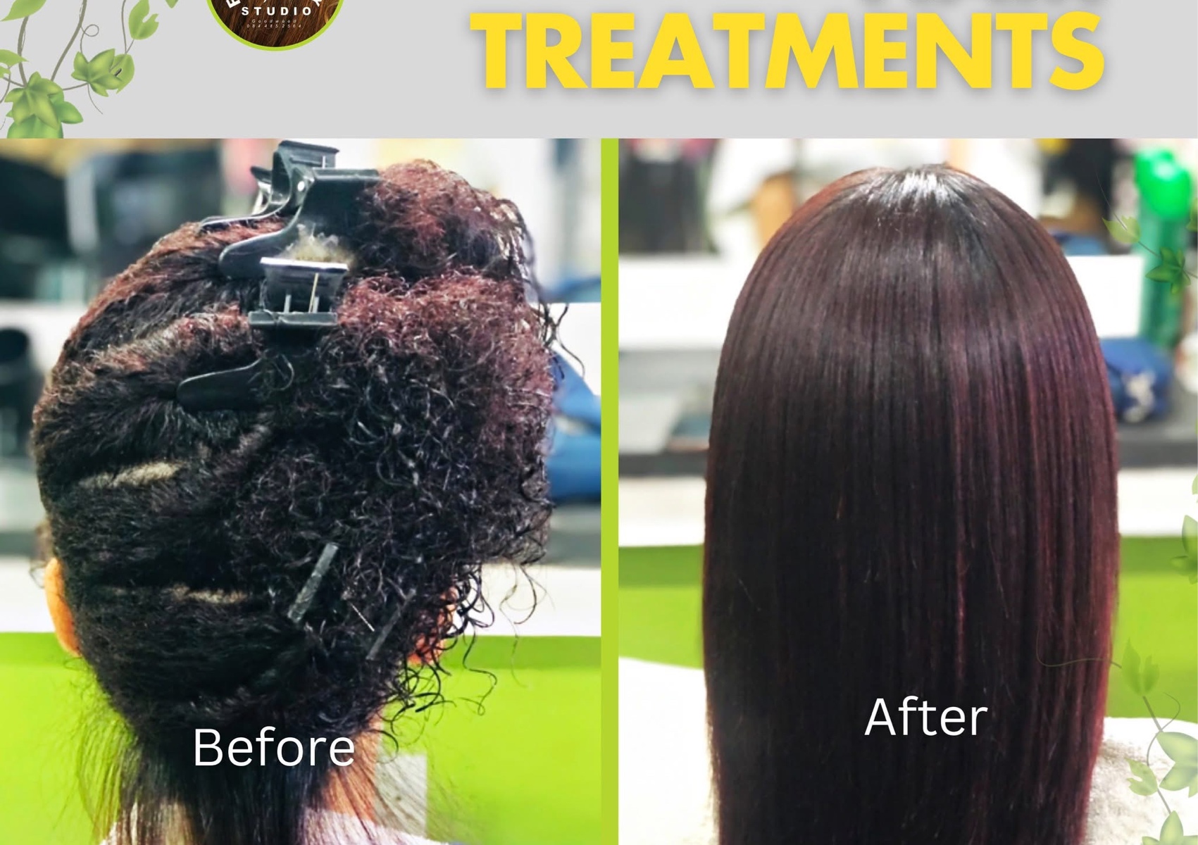 Botox  and Brazilian Treatment